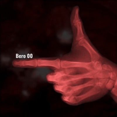  - Bero 00 (Remixes)